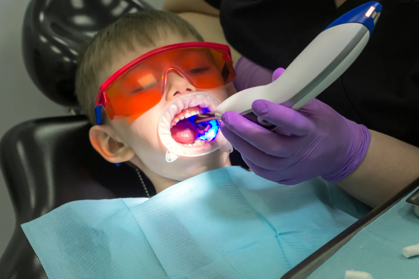Laser Dentistry